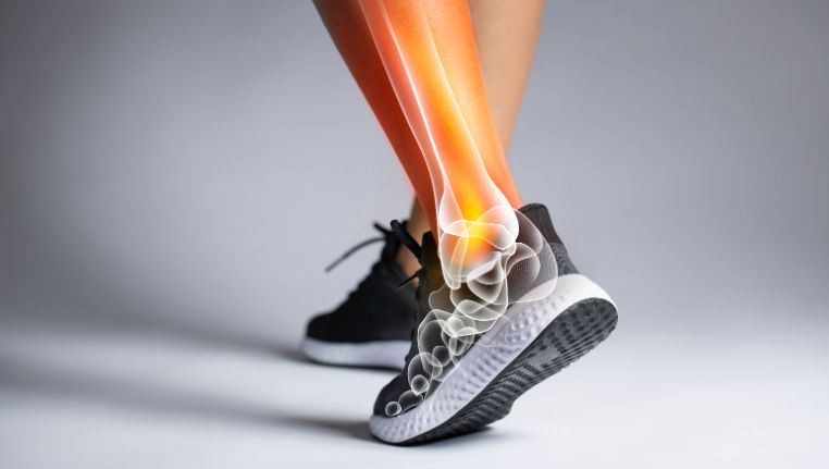 Bilde av ben med skjelett